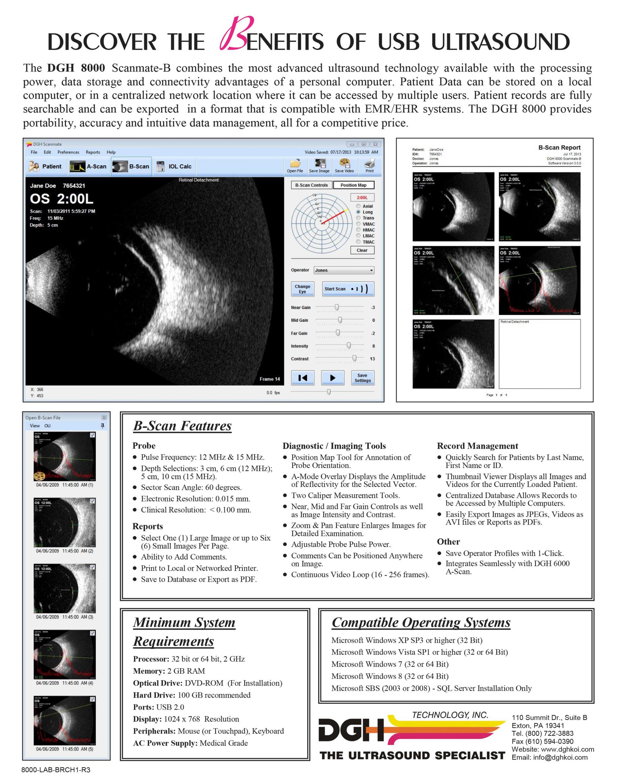 b-scan2-web